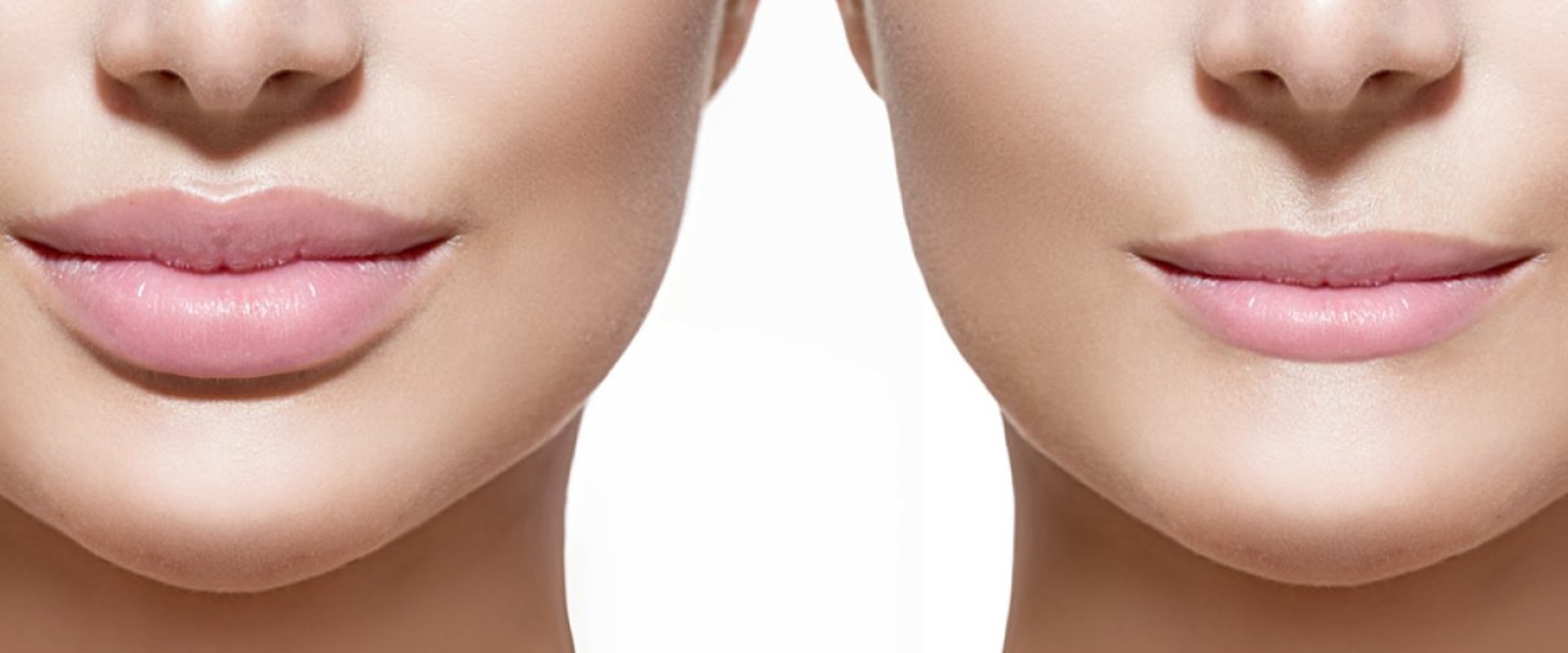 What Happens When Juvederm Wears Off?