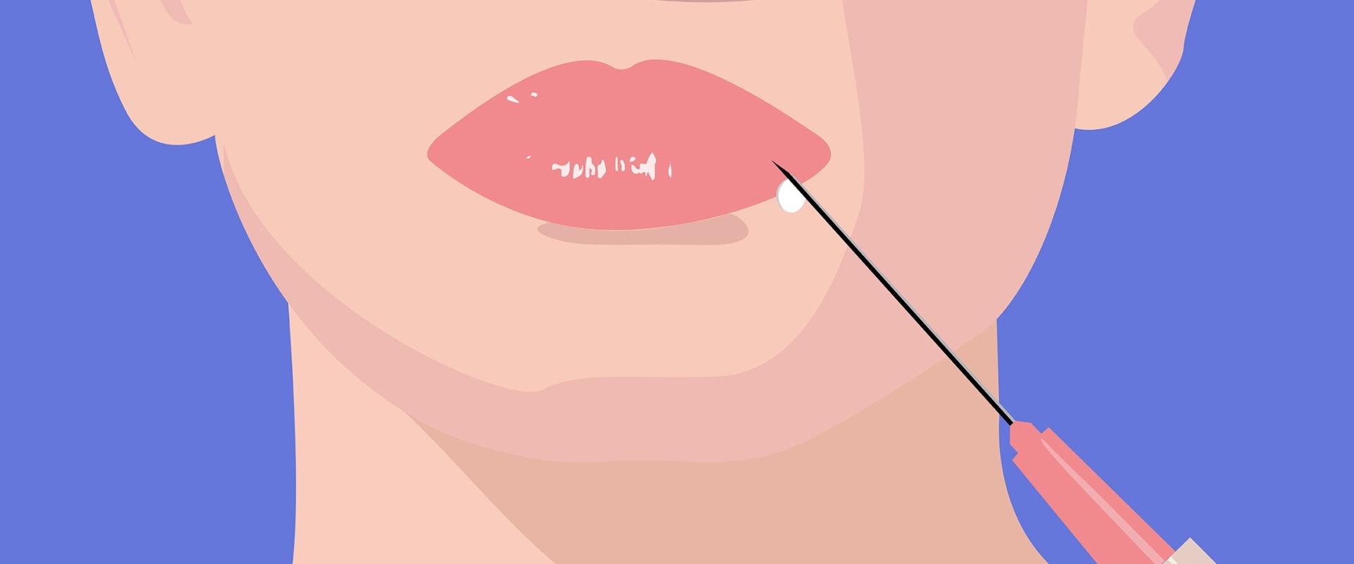 What Areas of the Face Can You Enhance with Juvederm?