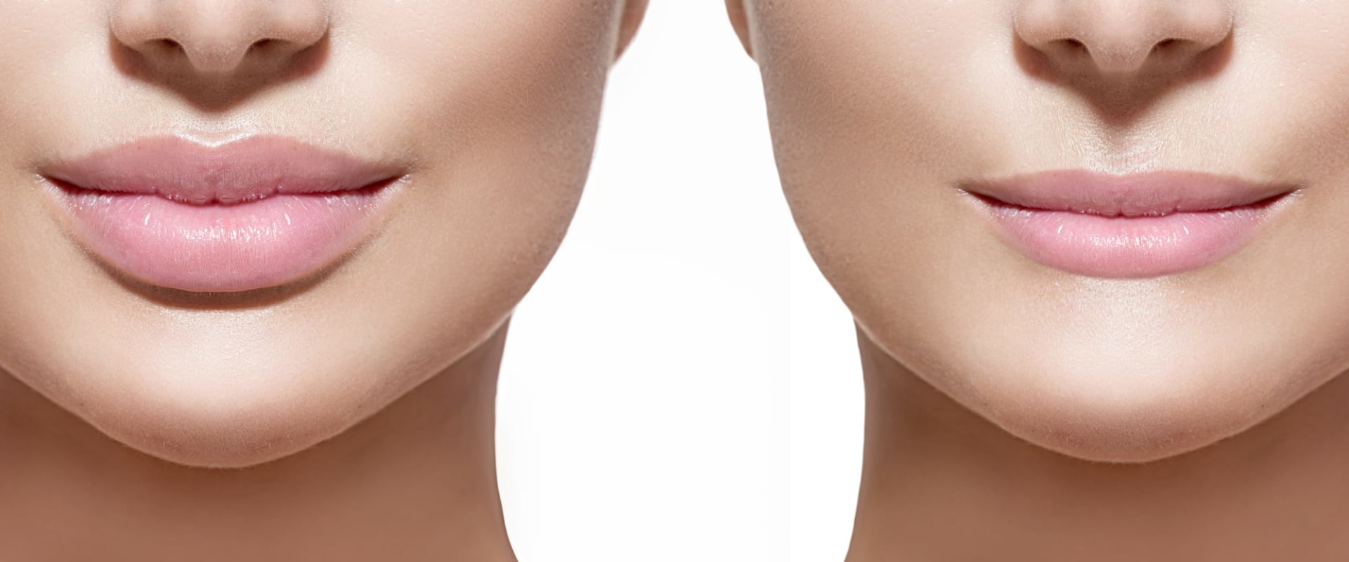 When Will Juvederm Lumps Disappear?