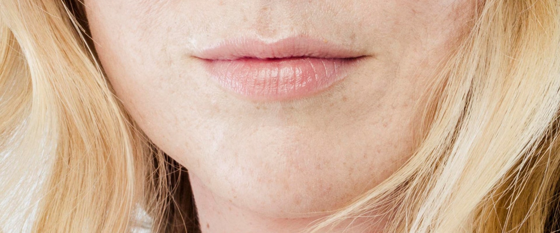Why is Juvederm So Expensive? An Expert's Perspective
