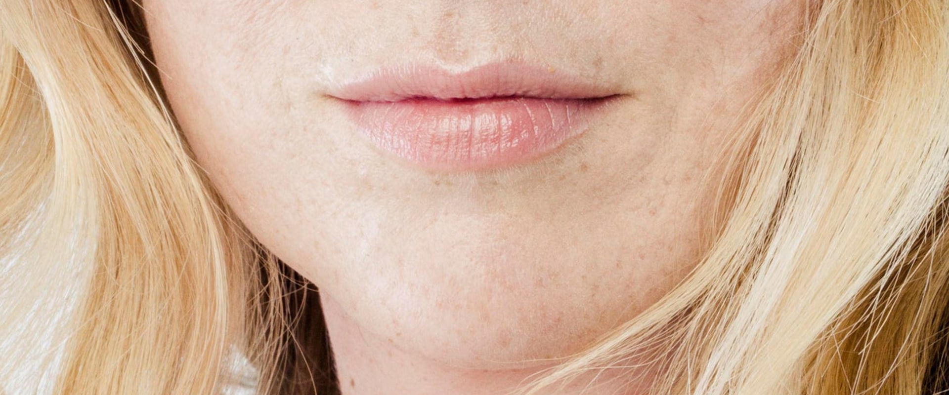 Why is juvederm so expensive?
