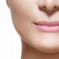 What Happens When Juvederm Wears Off?