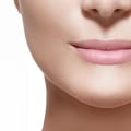 Why Juvederm is the Best Choice for Dermal Fillers