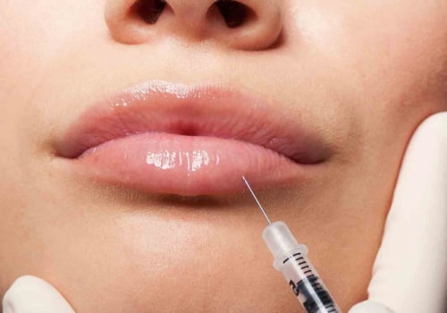 Are Juvederm Injections Painful? A Comprehensive Guide