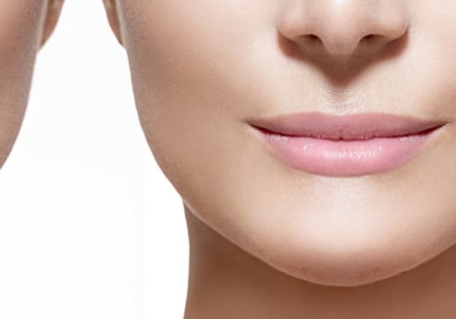 What Happens When Juvederm Wears Off?