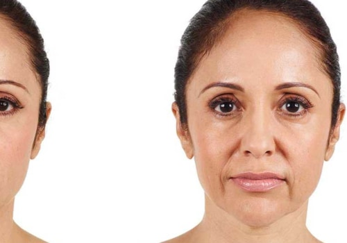 The Risks of Juvederm: What You Need to Know