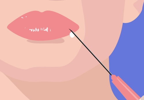 What Areas of the Face Can You Enhance with Juvederm?