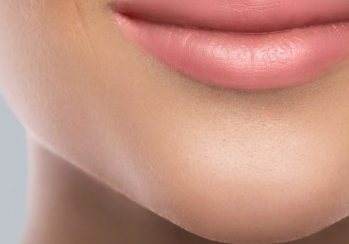 Which Juvederm Filler is Best for Lips?