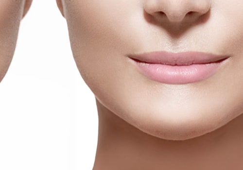 Which juvederm is used for lips?