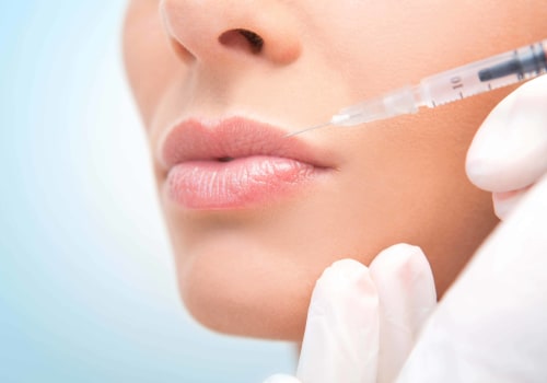 Can Juvederm Be Undone? A Comprehensive Guide