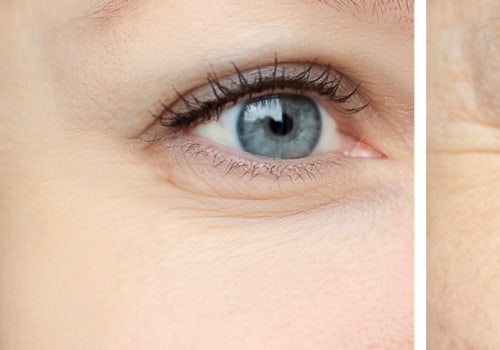 Are Juvederm and Botox Different Treatments for Wrinkles?