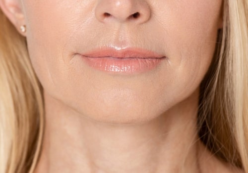 Can Juvederm Voluma Help Reduce Jowls?