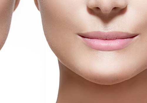 Juvederm how long to see results?